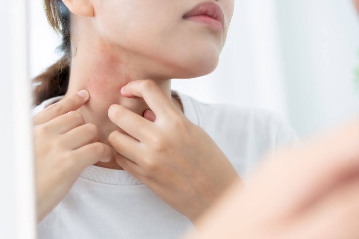 Close up of a woman looking in a mirror, examining an irritated, red patch of skin on her neck